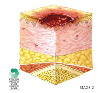 NPUAP-Stage2.jpg