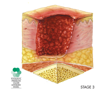 NPUAP-Stage3.jpg